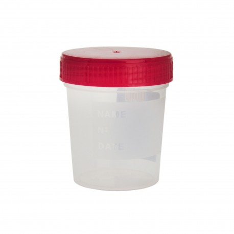 Urocultor steril, Minut