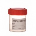 Urocultor steril, Minut
